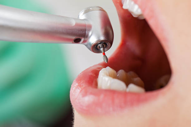 Best Walk-In Emergency Dental Services in Lexington, TX